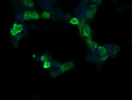 RASA1 Antibody in Immunocytochemistry (ICC/IF)