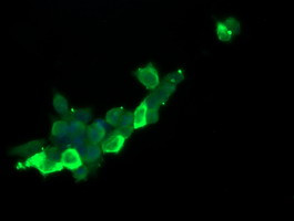 RASA1 Antibody in Immunocytochemistry (ICC/IF)