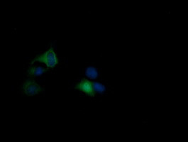 RASA1 Antibody in Immunocytochemistry (ICC/IF)