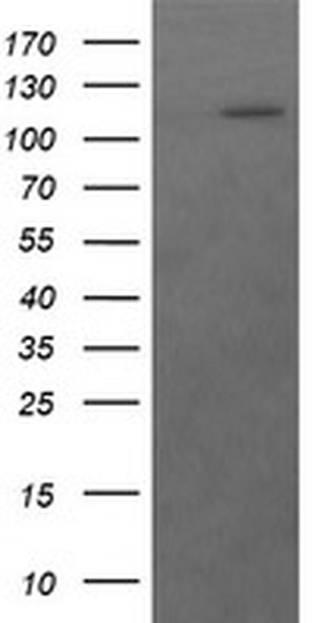 RASA1 Antibody in Western Blot (WB)