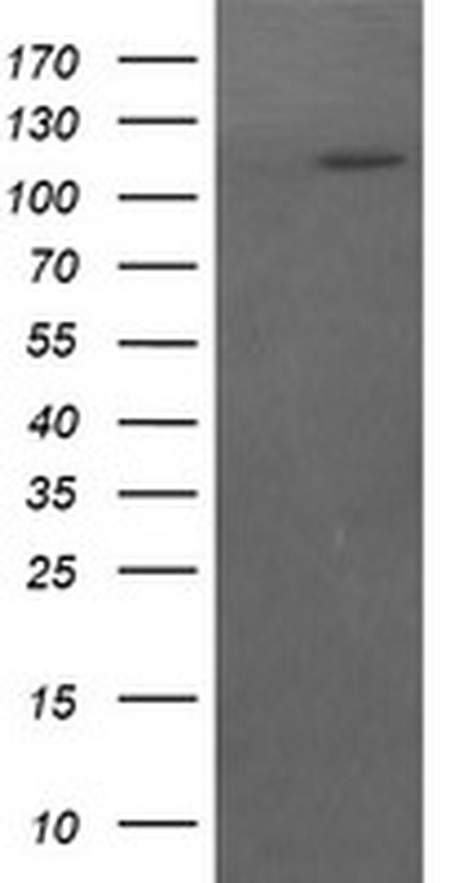 RASA1 Antibody in Western Blot (WB)