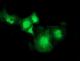 RASD2 Antibody in Immunocytochemistry (ICC/IF)