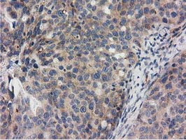 RASD2 Antibody in Immunohistochemistry (Paraffin) (IHC (P))