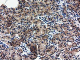 RASD2 Antibody in Immunohistochemistry (Paraffin) (IHC (P))