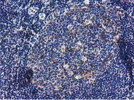 RASD2 Antibody in Immunohistochemistry (Paraffin) (IHC (P))