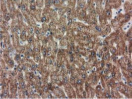 RASD2 Antibody in Immunohistochemistry (Paraffin) (IHC (P))