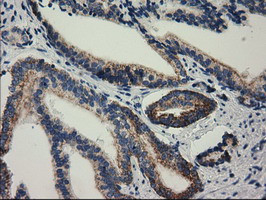 RASD2 Antibody in Immunohistochemistry (Paraffin) (IHC (P))