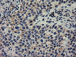 RASD2 Antibody in Immunohistochemistry (Paraffin) (IHC (P))