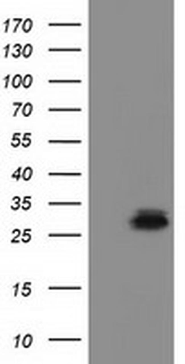 RASD2 Antibody in Western Blot (WB)