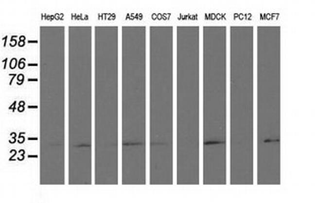 RASD2 Antibody in Western Blot (WB)