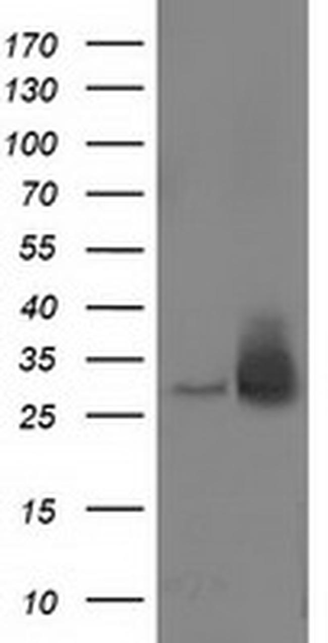 RASD2 Antibody in Western Blot (WB)