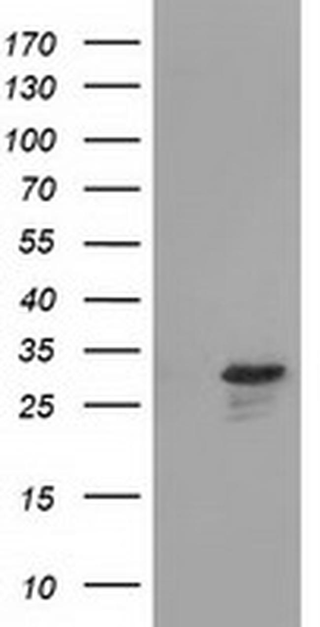 RASD2 Antibody in Western Blot (WB)