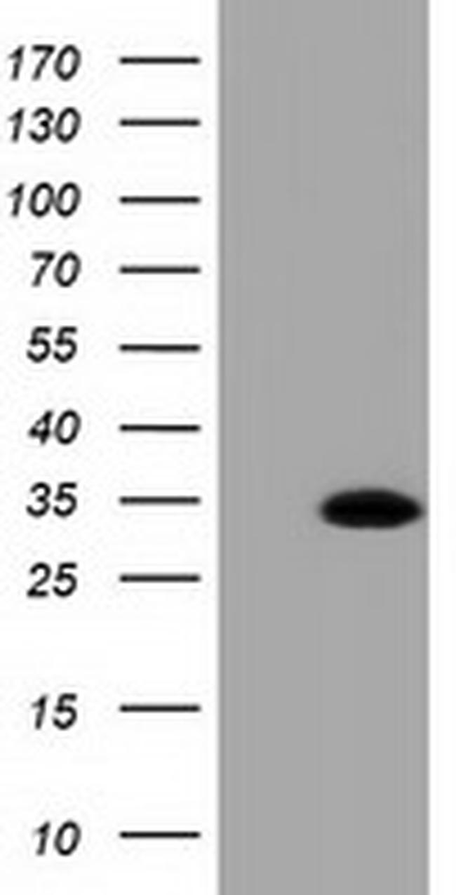 RASD2 Antibody in Western Blot (WB)