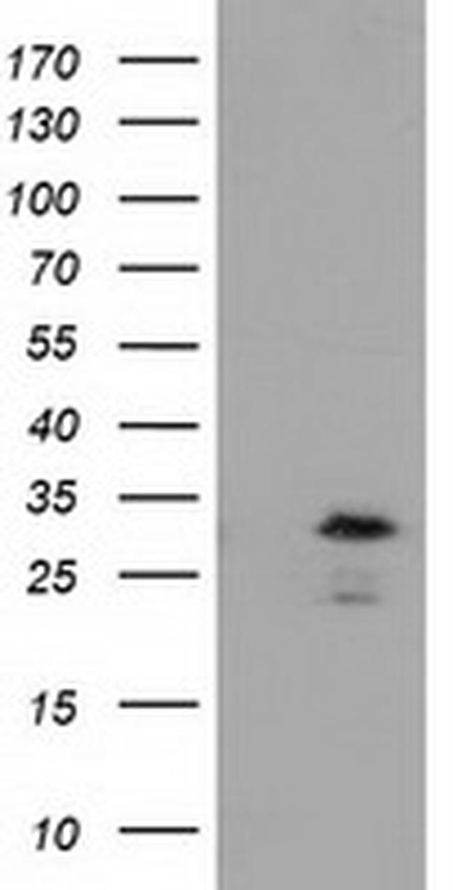 RASD2 Antibody in Western Blot (WB)