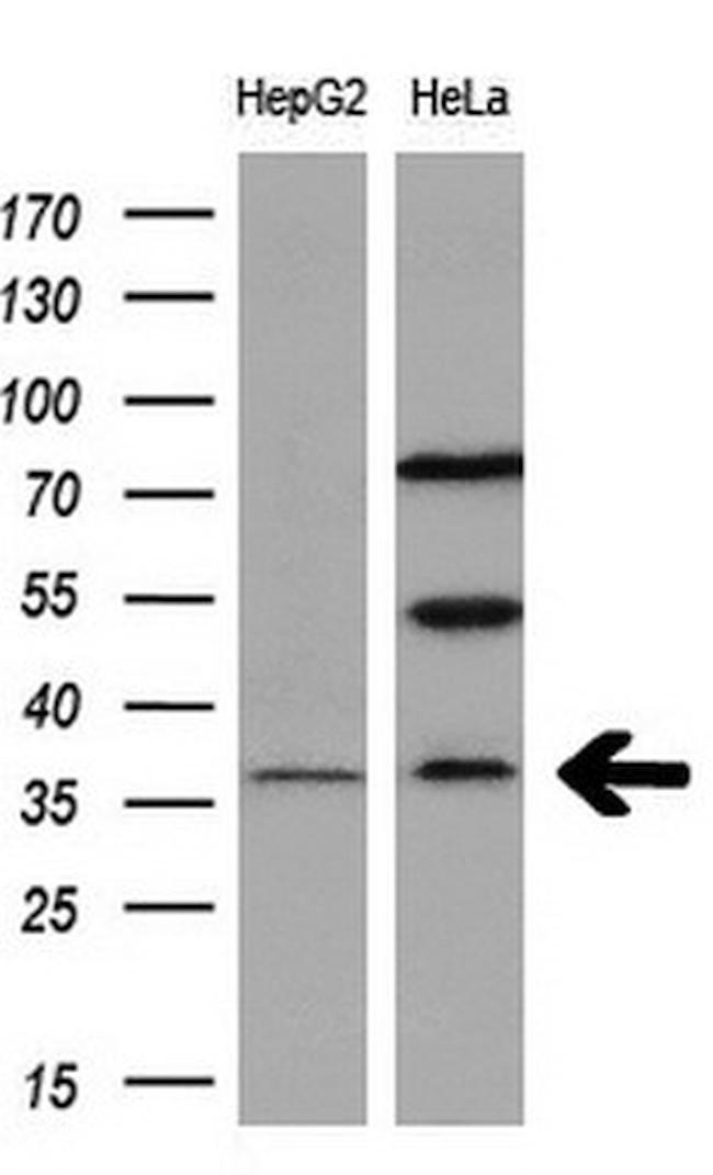 RASD2 Antibody in Western Blot (WB)