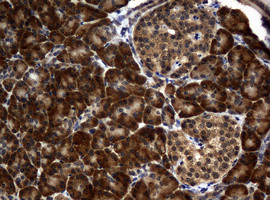 RASGRP3 Antibody in Immunohistochemistry (Paraffin) (IHC (P))