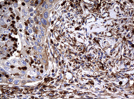 RASGRP3 Antibody in Immunohistochemistry (Paraffin) (IHC (P))