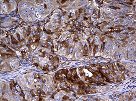 RASGRP3 Antibody in Immunohistochemistry (Paraffin) (IHC (P))