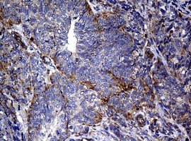 RASGRP3 Antibody in Immunohistochemistry (Paraffin) (IHC (P))