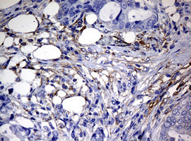 RASGRP3 Antibody in Immunohistochemistry (Paraffin) (IHC (P))