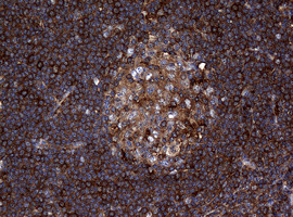 RASGRP3 Antibody in Immunohistochemistry (Paraffin) (IHC (P))