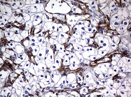 RASGRP3 Antibody in Immunohistochemistry (Paraffin) (IHC (P))