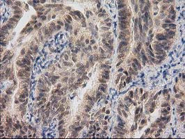 RASSF1 Antibody in Immunohistochemistry (Paraffin) (IHC (P))