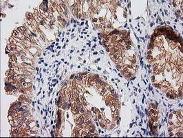 RASSF1 Antibody in Immunohistochemistry (Paraffin) (IHC (P))