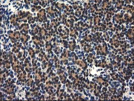 RASSF1 Antibody in Immunohistochemistry (Paraffin) (IHC (P))