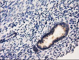 RASSF1 Antibody in Immunohistochemistry (Paraffin) (IHC (P))