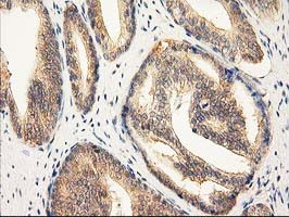 RASSF1 Antibody in Immunohistochemistry (Paraffin) (IHC (P))