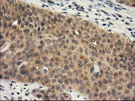 RASSF1 Antibody in Immunohistochemistry (Paraffin) (IHC (P))