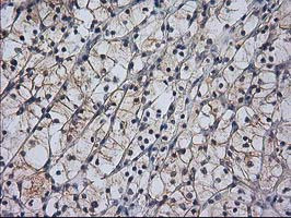 RASSF1 Antibody in Immunohistochemistry (Paraffin) (IHC (P))