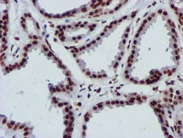 RASSF1 Antibody in Immunohistochemistry (Paraffin) (IHC (P))