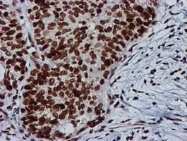 RASSF1 Antibody in Immunohistochemistry (Paraffin) (IHC (P))