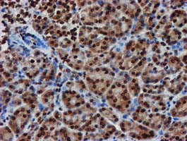 RASSF1 Antibody in Immunohistochemistry (Paraffin) (IHC (P))