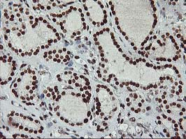 RASSF1 Antibody in Immunohistochemistry (Paraffin) (IHC (P))