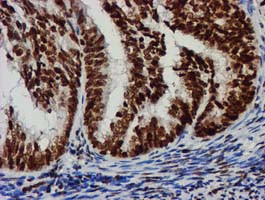 RASSF1 Antibody in Immunohistochemistry (Paraffin) (IHC (P))