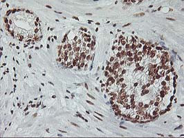 RASSF1 Antibody in Immunohistochemistry (Paraffin) (IHC (P))