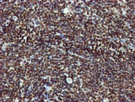 RASSF1 Antibody in Immunohistochemistry (Paraffin) (IHC (P))