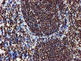 RASSF1 Antibody in Immunohistochemistry (Paraffin) (IHC (P))