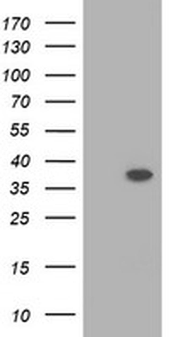 RASSF1 Antibody in Western Blot (WB)
