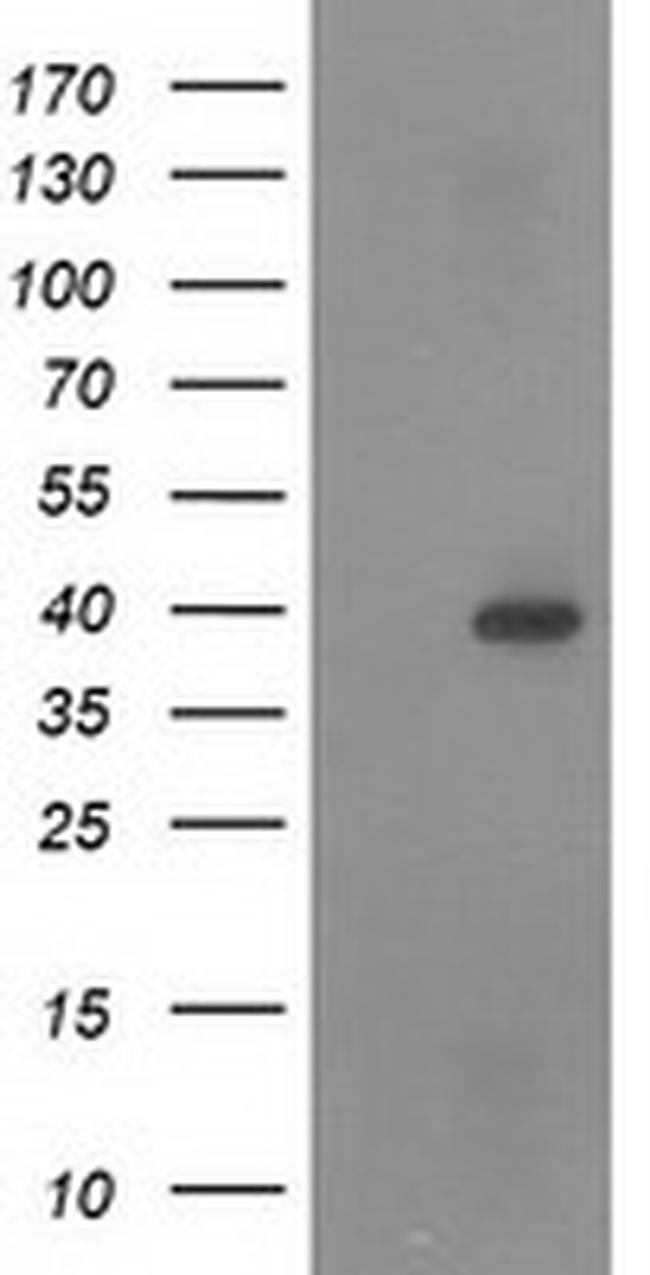 RASSF1 Antibody in Western Blot (WB)