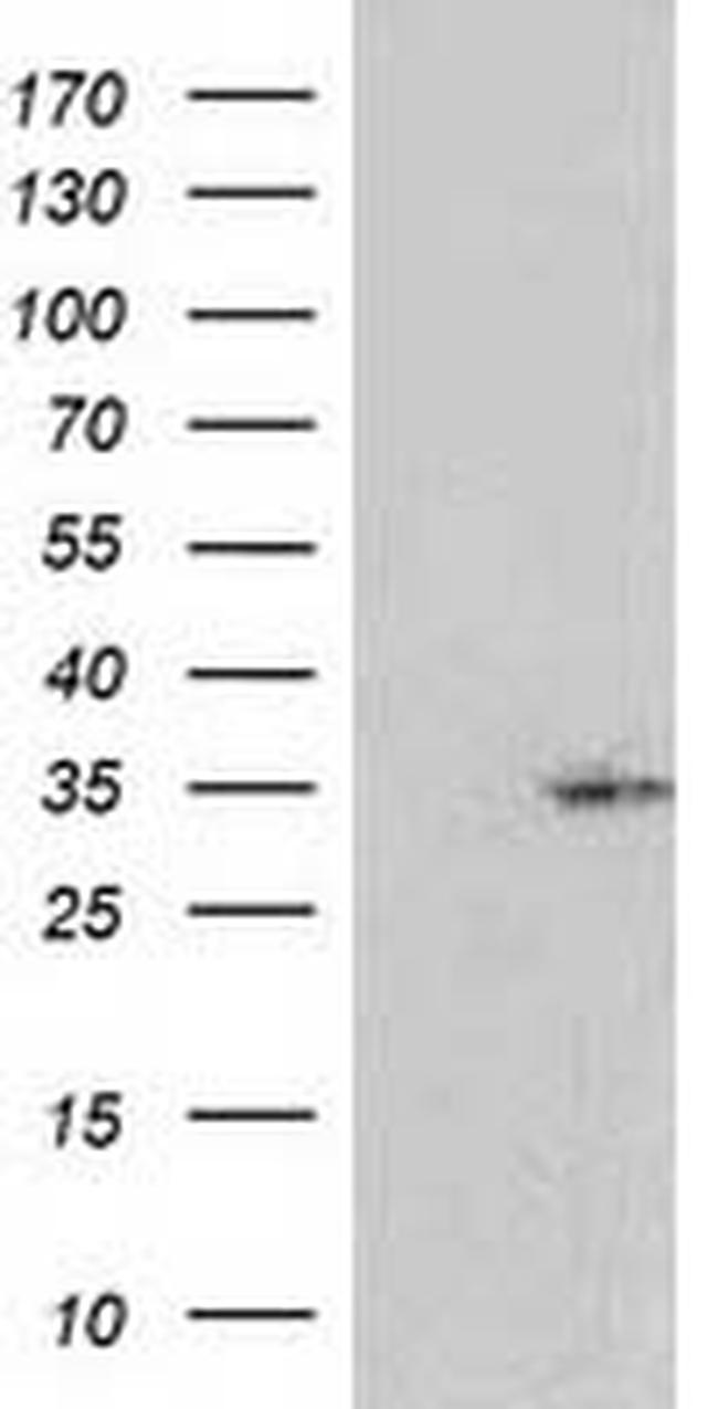 RASSF5 Antibody in Western Blot (WB)