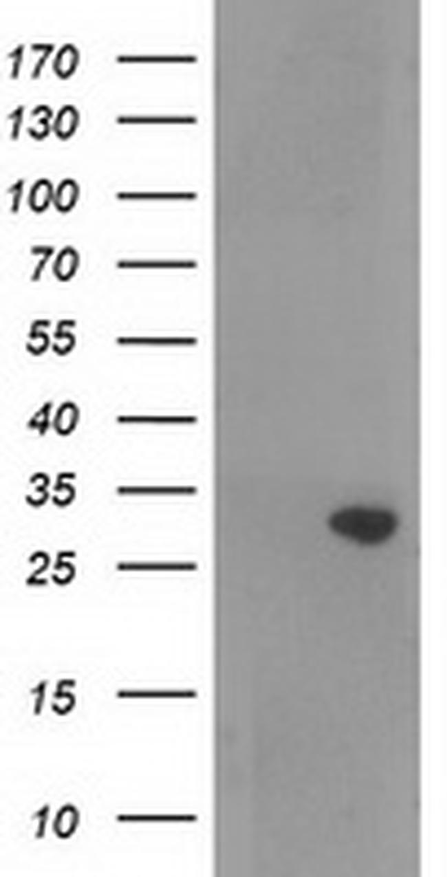 RASSF5 Antibody in Western Blot (WB)