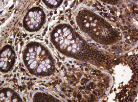 RASSF8 Antibody in Immunohistochemistry (Paraffin) (IHC (P))