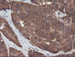 RASSF8 Antibody in Immunohistochemistry (Paraffin) (IHC (P))