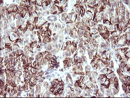 RASSF8 Antibody in Immunohistochemistry (Paraffin) (IHC (P))