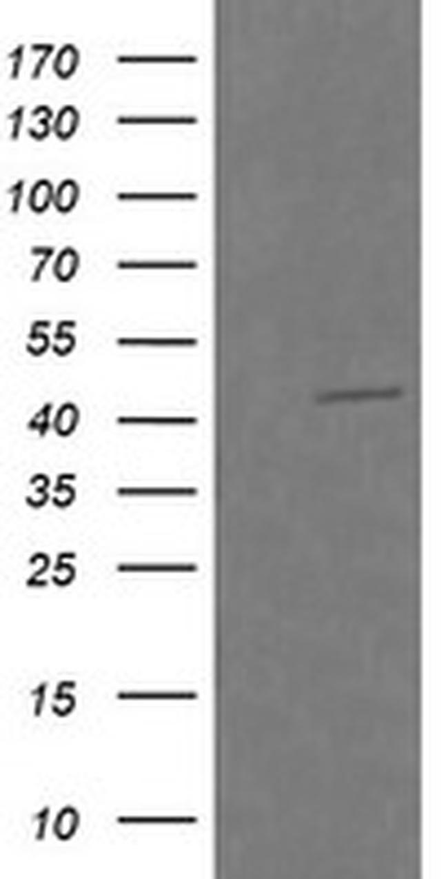 RASSF8 Antibody in Western Blot (WB)