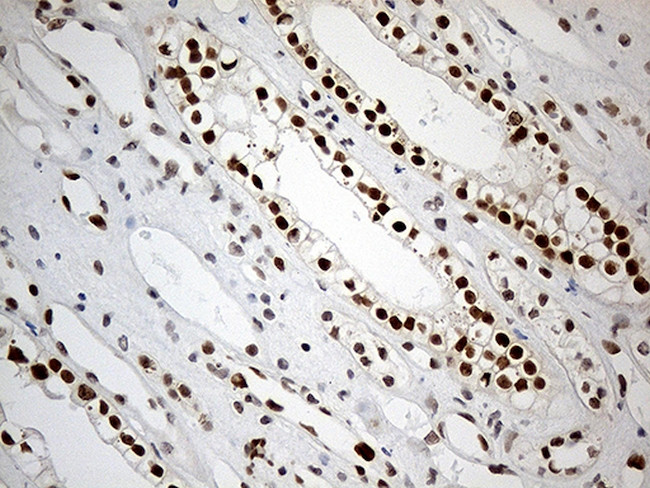 RB1 Antibody in Immunohistochemistry (Paraffin) (IHC (P))